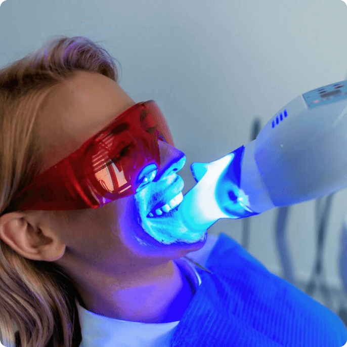 Teeth Whitening Treatment